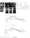 Fig. 06 - METHOD FOR PROVIDING OCULAR NEUROPROTECTION OR FOR PREVENTING, TREATING OR ALLEVIATING THE EFFECTS OF, AN OCULAR DISEASE ASSOCIATED WITH RETINAL GANGLION CELL DEATH