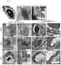 Fig. 07 - METHOD FOR PROVIDING OCULAR NEUROPROTECTION OR FOR PREVENTING, TREATING OR ALLEVIATING THE EFFECTS OF, AN OCULAR DISEASE ASSOCIATED WITH RETINAL GANGLION CELL DEATH