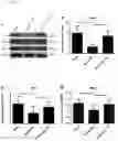 Fig. 08 - METHOD FOR PROVIDING OCULAR NEUROPROTECTION OR FOR PREVENTING, TREATING OR ALLEVIATING THE EFFECTS OF, AN OCULAR DISEASE ASSOCIATED WITH RETINAL GANGLION CELL DEATH