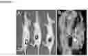 Fig. 08 - Synthetic Scaffolds for Metastasis Detection
