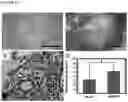 Fig. 11 - Synthetic Scaffolds for Metastasis Detection