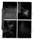 Fig. 02 - INTRAOPERATIVE DETERMINATION OF NERVE LOCATION