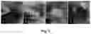 Fig. 03 - A SUPERABSORBENT POLYMER HYDROGEL XEROGEL SPONGE AND PREPARATION METHOD AND APPLICATION THEREOF