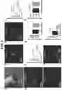 Fig. 06 - Biomaterials for neuronal implants and use of said biomaterials in the diagnosis and therapy of neuronal diseases