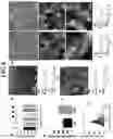 Fig. 07 - Biomaterials for neuronal implants and use of said biomaterials in the diagnosis and therapy of neuronal diseases