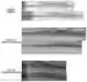 Fig. 01 - Indwelling catheter