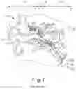 Fig. 02 - Multi-balloon instrument for dilating eustachian tube via middle ear