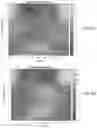 Fig. 09 - METHOD AND SYSTEM FOR ANALYZING INVASIVE BRAIN STIMULATIONS