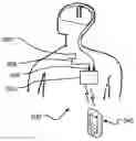 Fig. 01 - Adjustment of therapeutic stimulation
