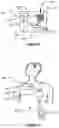 Fig. 04 - Adjustment of therapeutic stimulation