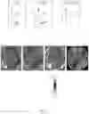 Fig. 06 - Use of transcranial magnetic stimulation to modulate permeability of the blood-brain barrier