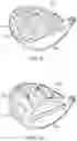 Fig. 07 - Multi-material golf club head