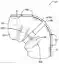 Fig. 01 - Methods and systems for jacket joints