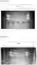 Fig. 12 - Methods and kits for isolating, capturing, and recovery of target macromolecules by gel electrophoresis