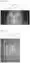 Fig. 19 - Methods and kits for isolating, capturing, and recovery of target macromolecules by gel electrophoresis