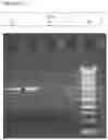 Fig. 20 - Methods and kits for isolating, capturing, and recovery of target macromolecules by gel electrophoresis