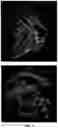 Fig. 02 - MODIFIED CK AND CH1 DOMAINS