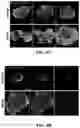 Fig. 07 - COMPOSITION FOR CULTURING BRAIN ORGANOID BASED ON DECELLULARIZED BRAIN MATRIX AND METHOD FOR PREPARING SAME