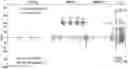 Fig. 01 - METHODS AND COMPOSITIONS RELATING TO DETECTION OF RECOMBINATION AND REARRANGEMENT EVENTS