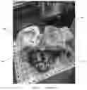 Fig. 08 - METHODS AND APPARATUS FOR AN ACTIVELY COOLED CYLINDER BLOCK