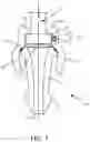 Fig. 06 - Single-use pressure transducer disposable interface