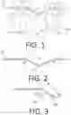 Fig. 02 - Systems and methods for forming a desired bend angle in an orthodontic appliance
