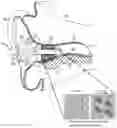 Fig. 01 - Methods and devices for attenuating sound in a conduit or chamber