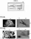 Fig. 02 - Medical image diagnostic apparatus, image processing apparatus, and registration method