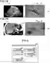 Fig. 07 - Medical image diagnostic apparatus, image processing apparatus, and registration method
