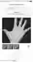 Fig. 07 - A SYSTEM AND METHOD OF DIAGNOSIS SKIN AND TISSUE LESIONS AND ABNORMALITIES