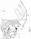 Fig. 02 - Cable-jacket removal tool