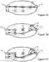 Fig. 02 - Method and detector for resolving unicast flooding