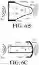 Fig. 08 - Hearing device comprising a feedback reduction system