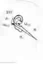 Fig. 01 - Hearing device adapted for matching input transducers using the voice of a wearer of the hearing device