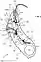 Fig. 02 - HEARING DEVICE COMPRISING A LIGHT SOURCE