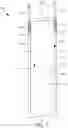 Fig. 02 - Over the door mirror apparatus