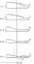 Fig. 12 - CPAP pillow apparatus and method