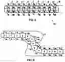 Fig. 07 - APPARATUS AND METHOD FOR ENDOSCOPIC COLECTOMY