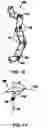 Fig. 08 - APPARATUS AND METHOD FOR ENDOSCOPIC COLECTOMY