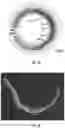 Fig. 07 - Device and methods for color corrected OCT imaging endoscope/catheter/capsule to achieve high-resolution