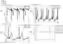 Fig. 16 - ELECTRIC BIOPOTENTIAL SIGNAL MAPPING CALIBRATION, ESTIMATION, SOURCE SEPARATION, SOURCE LOCALIZATION, STIMULATION, AND NEUTRALIZATION.