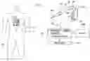 Fig. 01 - Introducer sheath localization and visualization