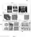 Fig. 05 - Radiomic features of prostate bi-parametric magnetic resonance imaging (BPMRI) associate with decipher score