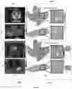 Fig. 10 - Radiomic features of prostate bi-parametric magnetic resonance imaging (BPMRI) associate with decipher score