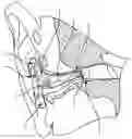 Fig. 01 - Apparatus for manipulation of ear devices