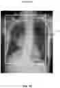 Fig. 17 - Imaging method and system for determining a scan area