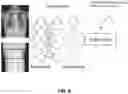 Fig. 10 - Methods and systems for modulating radiation dose