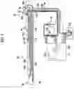 Fig. 03 - Ultrasonic endoscope