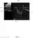 Fig. 04 - ULTRASONOGRAPHIC METHOD FOR MEASURING MUSCLE DEFORMATION