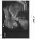 Fig. 05 - ULTRASOUND APPARATUS AND METHOD
